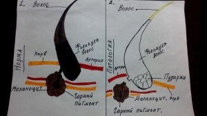 СЕДИНА. Как лечить седые волосы. Причина и механизм развития. КАРАГАНДА ЦЕНТРАЛЬНЫЙ ПАРК.