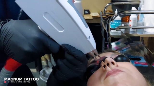 Осветление перманентного макияжа бровей Калининград Magnum Tattoo