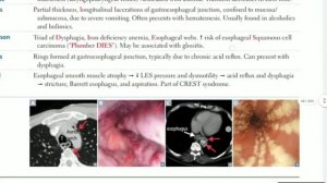 Up To Date - GIT PATHOLOGY (part 2) [ esophageal pathology ]