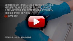 Особенности проведения одномоментной имплантации в области резцов, клыков и премоляров