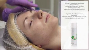 Активная процедура молочного пилинга ONmacabim. Active lactic peeling.
