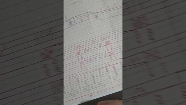 Проложение проектной линии на продольном профиле