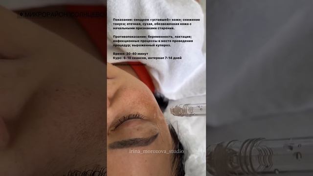 Газожидкостный пилинг в косметологии смотреть онлайн