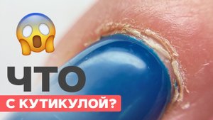 Что случилось с кутикулой? | Аппаратный маникюр подробно
