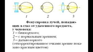 § 15 Заболевания и повреждения глаз