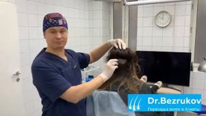 Пересадка волос у женщин в клинике доктора Безрукова