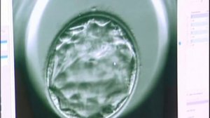 Эмбриоскопия - оценка качества эмбрионов