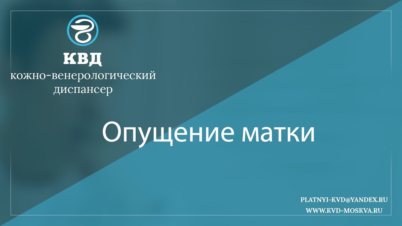 997  Опущение матки