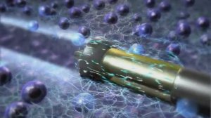 Нуклеопластика