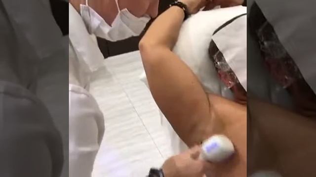 Лазерная диодная эпиляция смотреть онлайн