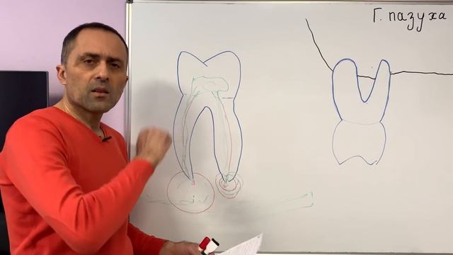 Заблуждения лечения кисты зуба, периодонтита. Киста зуба как лечить. Киста зуба видео. Эндодонтист смотреть онлайн