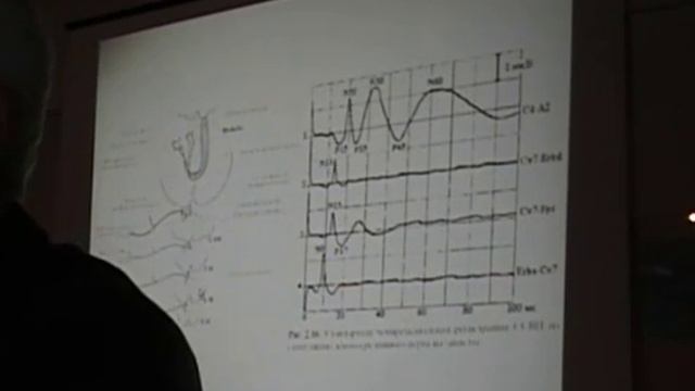 ЭЭГ при коме. смотреть онлайн