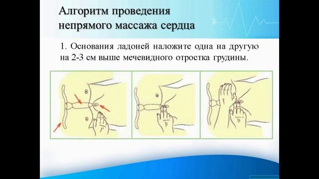 Тема 3. Реанимация: алгоритм оценки состояния пострадавшего; алгоритм проведения вентиляции лёгких смотреть онлайн