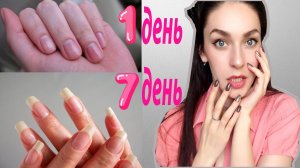 Как отрастить  ДЛИННЫЕ НОГТИ ЗА НЕДЕЛЮ в домашних условиях. Что делать если СЛОЯТЬСЯ и НЕ РАСТУТ?