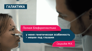 "Перезагрузка" на ТНТ: Операция блефаропластика круговая I Свиридов Максим Константинович