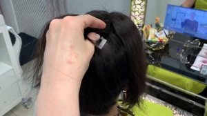 Видео-отзыв о системе замещения волос hairtalk