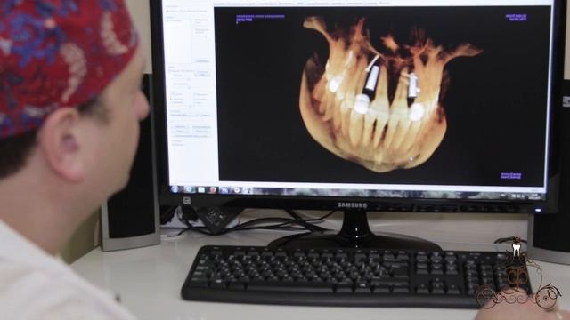 Имплантация как искусство! Что делать если не выросли боковые резцы? Отсутствие боковых резцов! смотреть онлайн