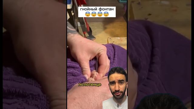 гнойный фонтан, заказывали? смотреть онлайн