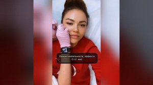 Инъекционная  косметология. Скулы с помощью филлера Neauvia organic. Моделируем скулы филлером.