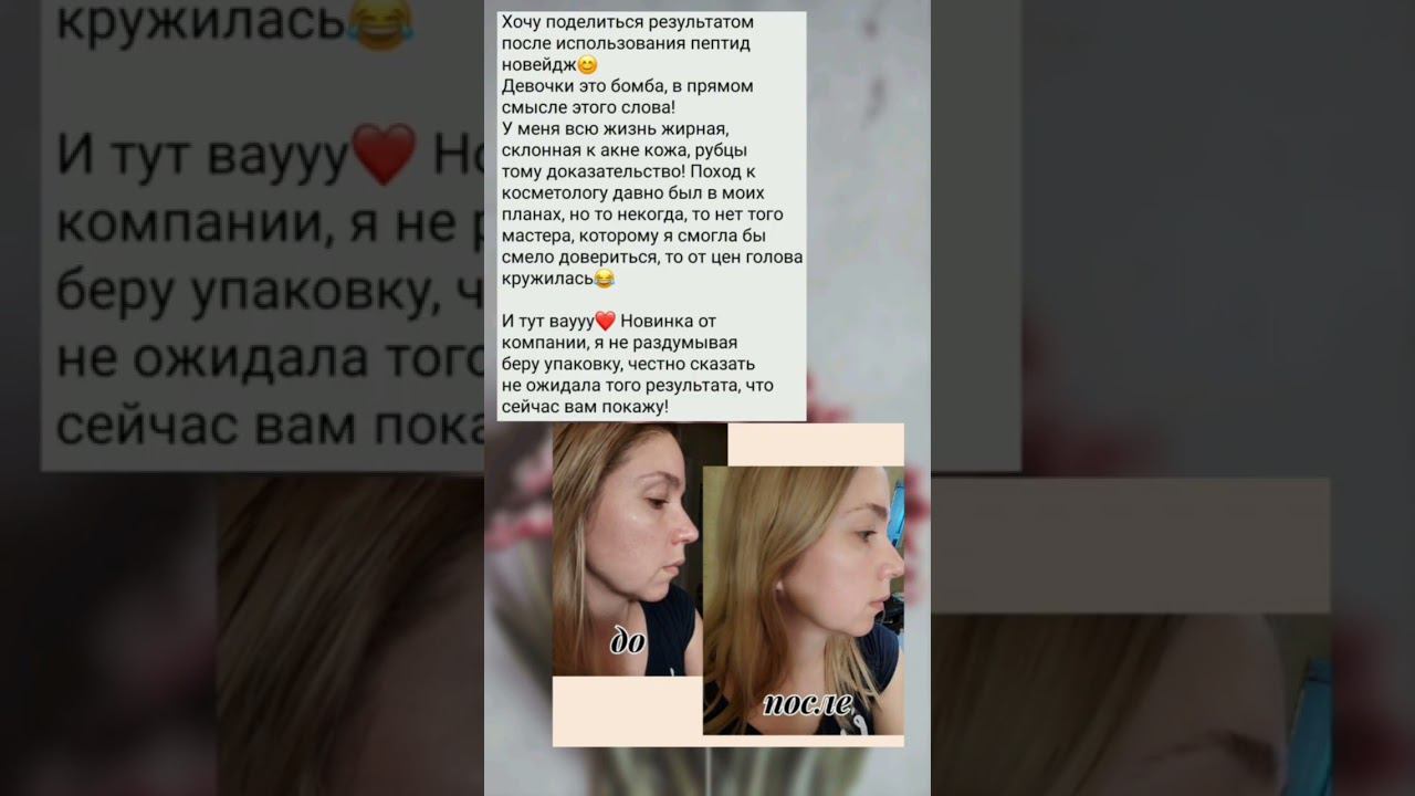 Шок‼️Идеальная кожа без косметолога #идеалтнаякожа #каксделатькожуидеальной #чистаякожа