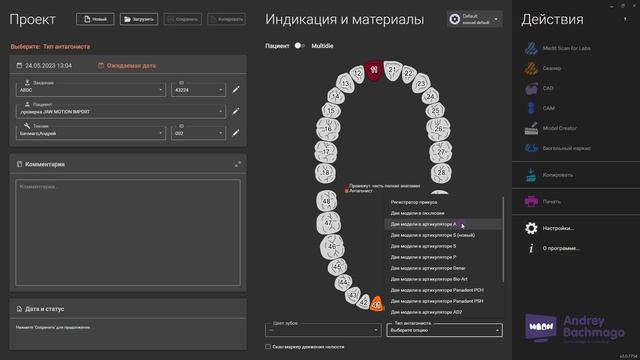проверка активации модуля JAW MOTION IMPORT в exocad 3.0 и 3.1