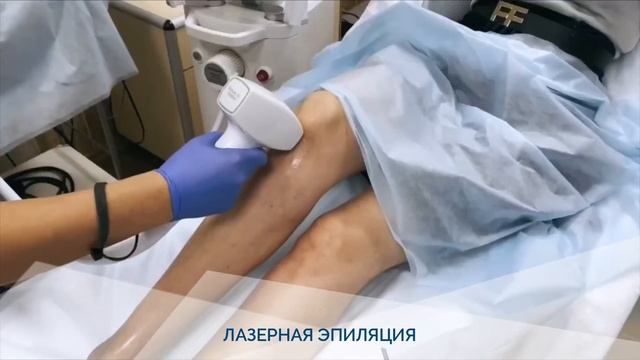 Лазерная эпиляция Diolaze смотреть онлайн