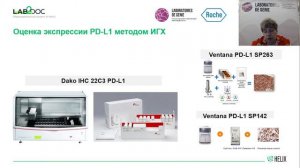 Сопроводительные иммуноморфологические маркеры при диагностике рака легкого