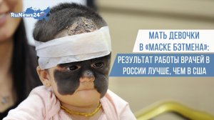 Мать девочки в «маске Бэтмена»: результат работы врачей в России лучше, чем в США
