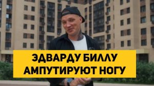 Эдварду Биллу ампутируют ногу