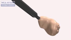 Чистка корпуса внутриушного слухового аппарата