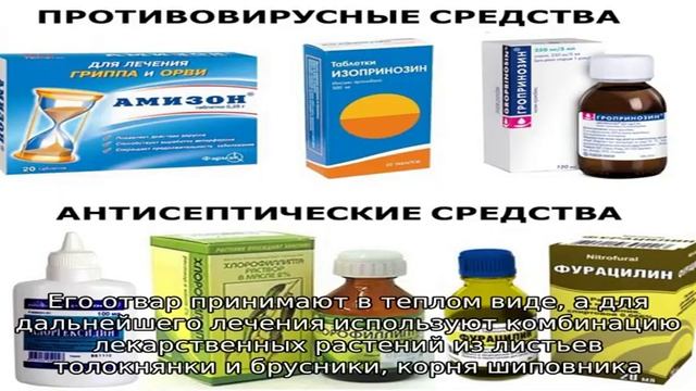 Урологический сбор при цистите смотреть онлайн