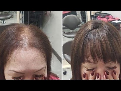 Сильнейшая Маска от выпадения волос!  Гипотериоз! Гипертериоз! Маска от выпадения волос!