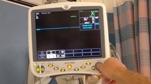 GE Dash 5000 Patient Monitor: COM ports, RS232, and Service Mode (Vitalsguy.com)