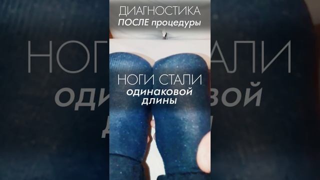 Искривления тела, заметные невооружённым взглядом! Ноги разной длины. Акупрессура подзатылочных мышц