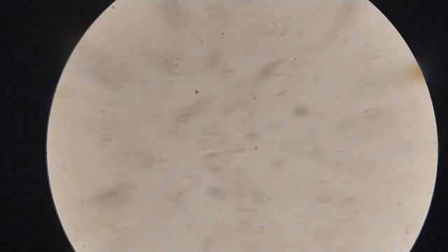 Кровь после настоя мяты смотреть онлайн