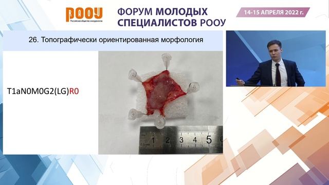 Лазерная En-block резекция стенки мочевого пузыря. Кисляков Д. А. смотреть онлайн