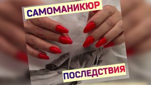 Маникюр Самой Себе. Что Делать Мастеру с этим "Счастьем"?. Выравнивание Клюющих Ногтей.