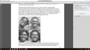 ОТ ЧЕГО ГНИЮТ ЗУБЫ?