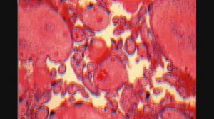 ПЛАЦЕНТА МАТЕРИНСКАЯ ЧАСТЬ  гистологическое строение  PLACENTA