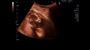 ПЕРВАЯ БЕРЕМЕННОСТЬ | Топ фактов которые нужно знать каждой женщине во время беременности