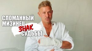 Сломанный мизинец это знак судьбы