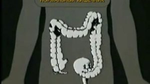 Необходимость очищения Кишечника