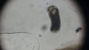 Паразиты аквариумных рыб - новорожденная глиста