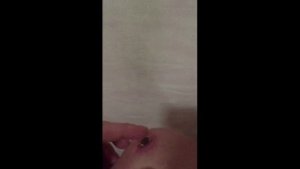 Обзор болячки на коленке, как избавиться?