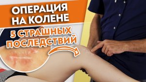 5 СТРАШНЫХ последствий операции на колене.
Как восстановиться после артроскопии?