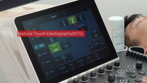 УЗИ АППАРАТ MINDRAY RESONA 7