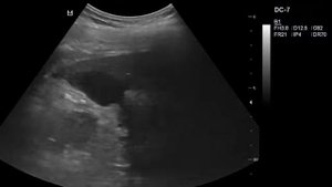 ПАРАНЕФРАЛЬНО