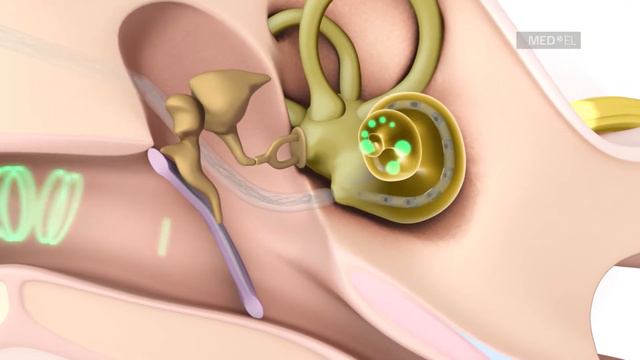How the SYNCHRONY EAS System Works смотреть онлайн