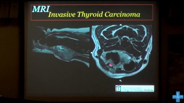 МРТ при абдоминальных и онкологических заболеваниях смотреть онлайн