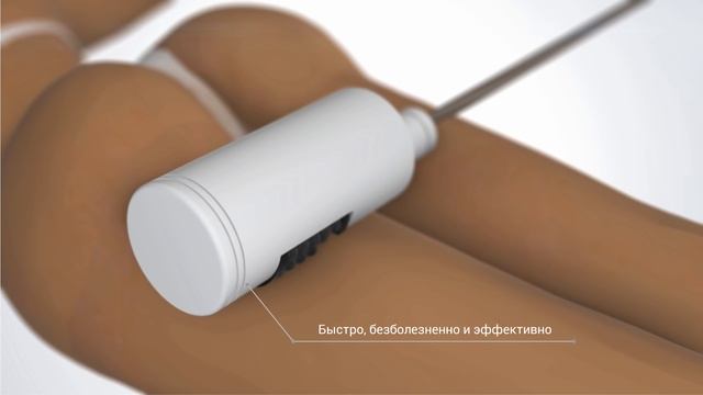 Инновационная методика в коррекции фигуры R sleek смотреть онлайн